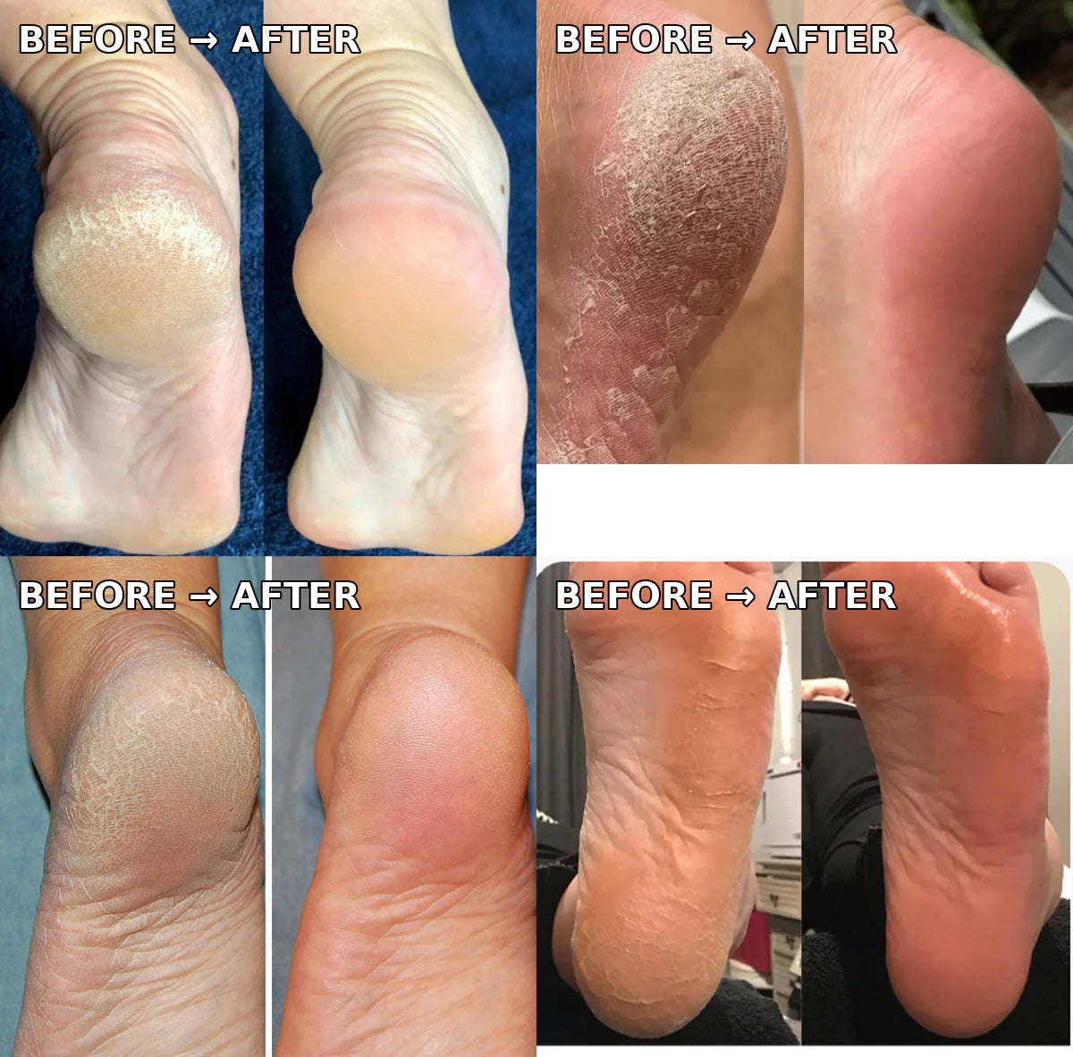 Electric Pedicure Foot File & Callus Remover